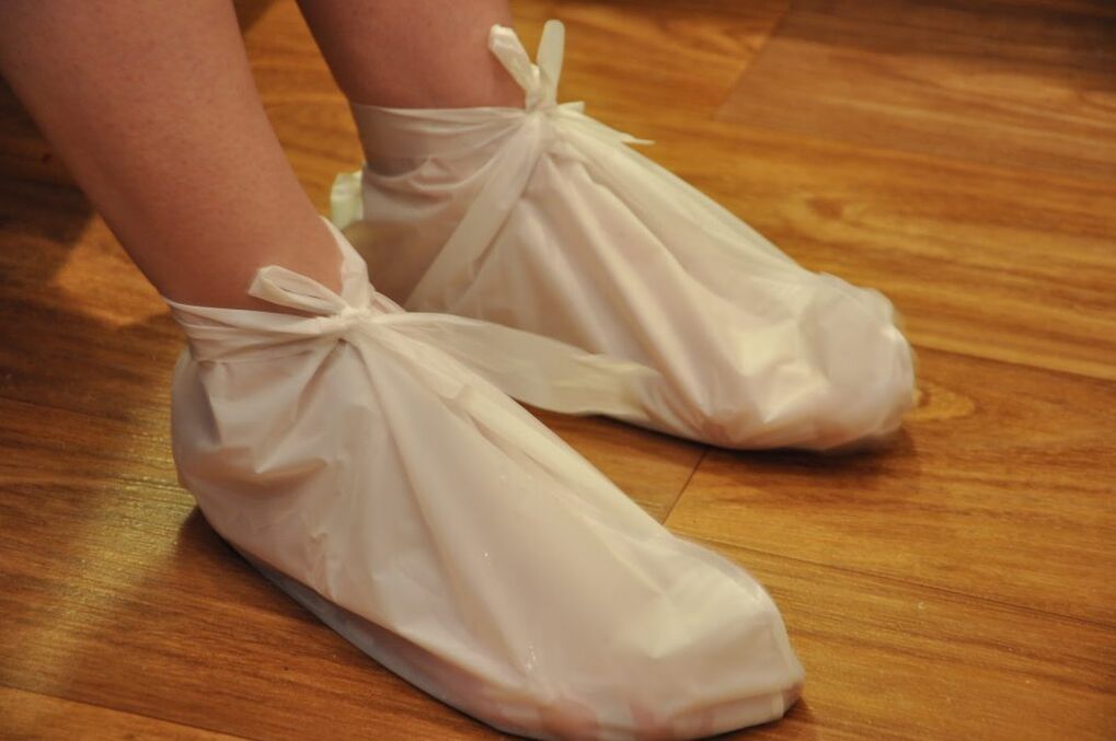 kompressid pahkluu artroosi jaoks