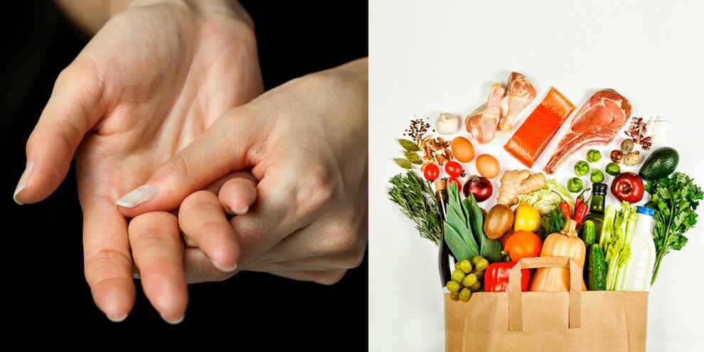 podagraalne käte artriit ja toidud selle raviks