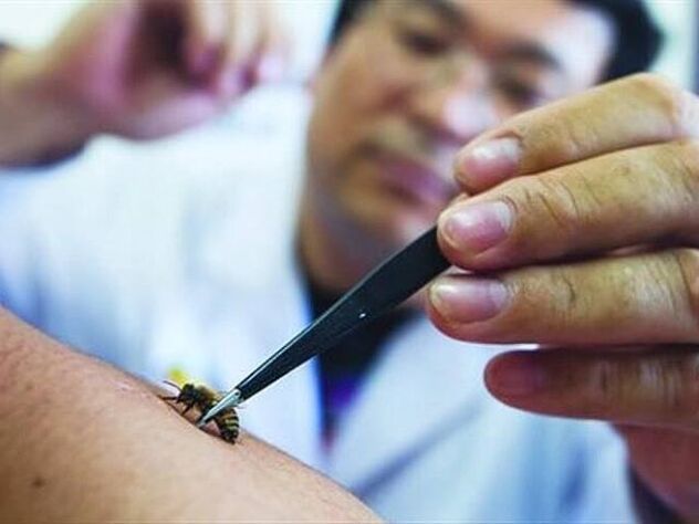 emakakaela osteokondroosi apiteraapia